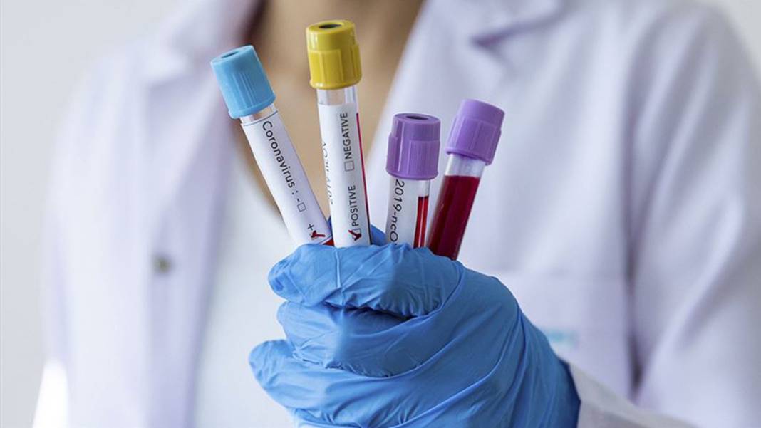 Koronavirüs değil bocavirüs! Ama bu da ölüme kadar gidiyor: İşte belirtileri 3